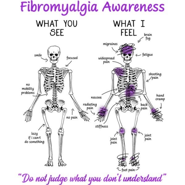 Fibromyalgia Awareness What You See What I Feel Skeleton T Shirt Thumbnail